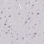 Immunohistochemical staining of human cerebral cortex shows low expression as expected.
