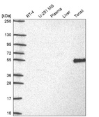 Western blot analysis in human cell line RT-4, human cell line U-251 MG, human plasma, human liver tissue and human tonsil tissue.