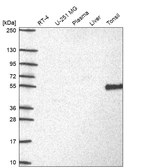 Western blot analysis in human cell line RT-4, human cell line U-251 MG, human plasma, human liver tissue and human tonsil tissue.