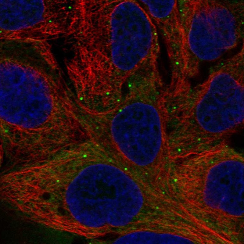 Anti-NPPB Antibody