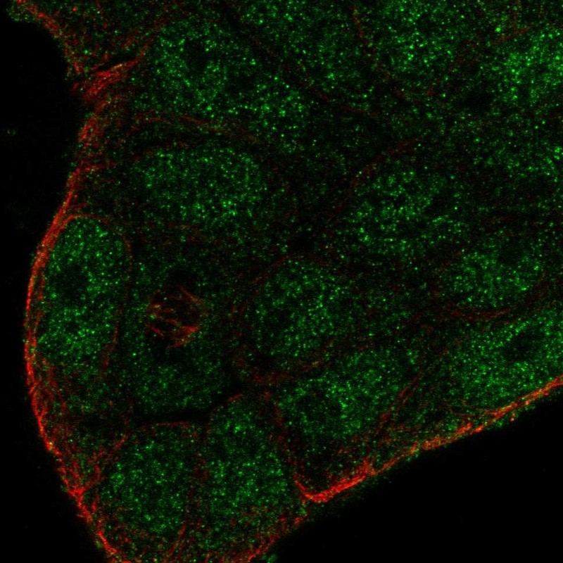 Anti-SMIM22 Antibody