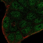 Anti-SMIM22 Antibody