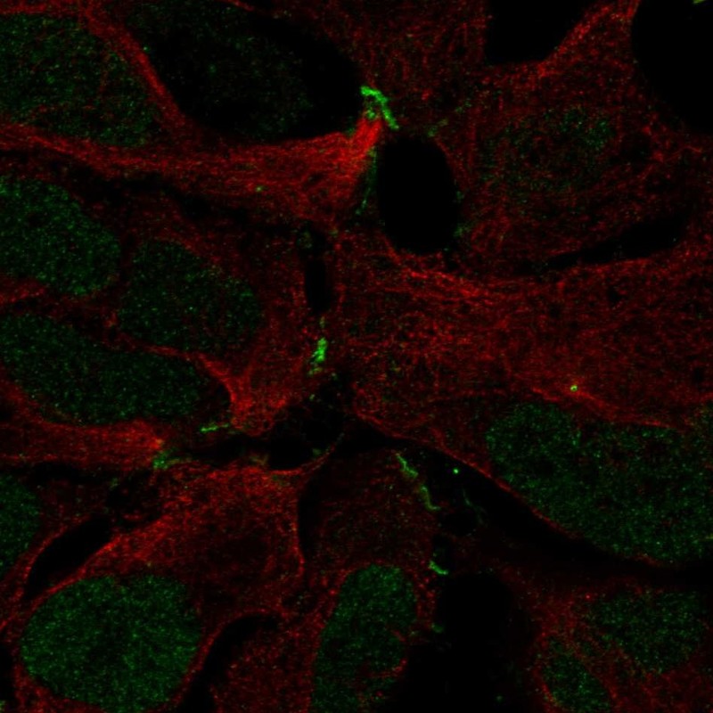 Anti-ZNF536 Antibody