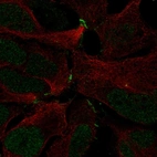 Anti-ZNF536 Antibody