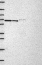 Lane 1: Marker [kDa] 250, 130, 95, 72, 55, 36, 28, 17, 10 | Lane 2: RT4 | Lane 3: U-251 MG | Lane 4: Human Plasma | Lane 5: Liver | Lane 6: Tonsil
