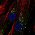 Anti-CHI3L1 Antibody