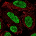 Anti-HMGN2 Antibody