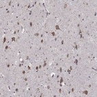 Anti-NKIRAS1 Antibody