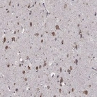 Anti-NKIRAS1 Antibody
