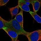 Immunofluorescent staining of human cell line SH-SY5Y shows localization to cytosol & endoplasmic reticulum.