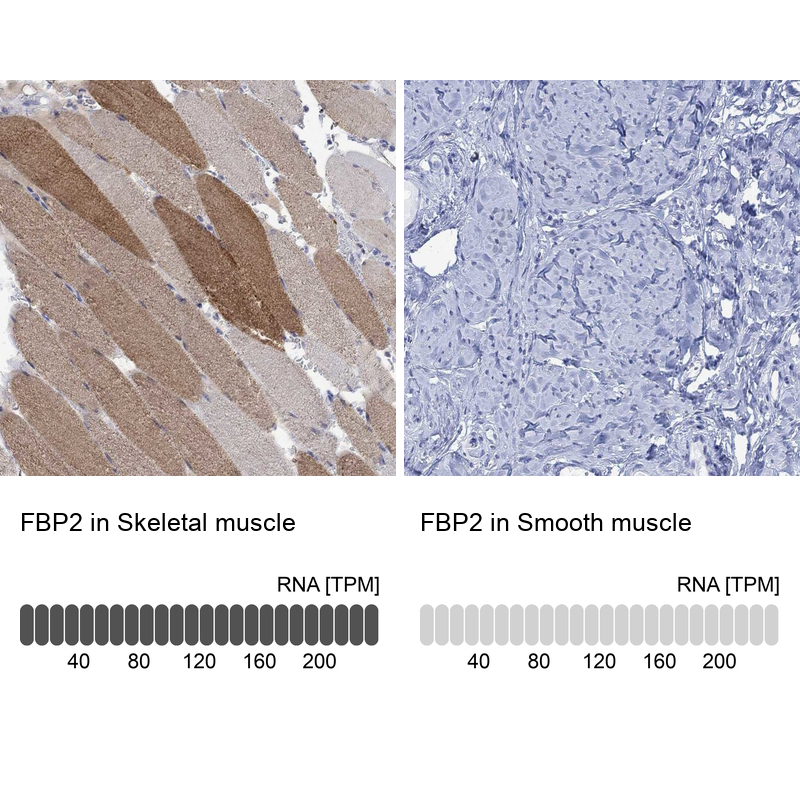 Anti-FBP2 Antibody