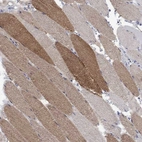Immunohistochemical staining of human skeletal muscle shows high expression.