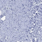 Immunohistochemical staining of human smooth muscle shows low expression as expected.