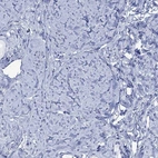 Immunohistochemical staining of human smooth muscle shows low expression as expected.