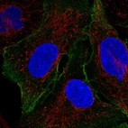 Immunofluorescent staining of human cell line U-2 OS shows localization to plasma membrane.