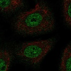 Anti-TSC22D1 Antibody