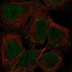 Immunofluorescent staining of human cell line U-2 OS shows localization to vesicles.