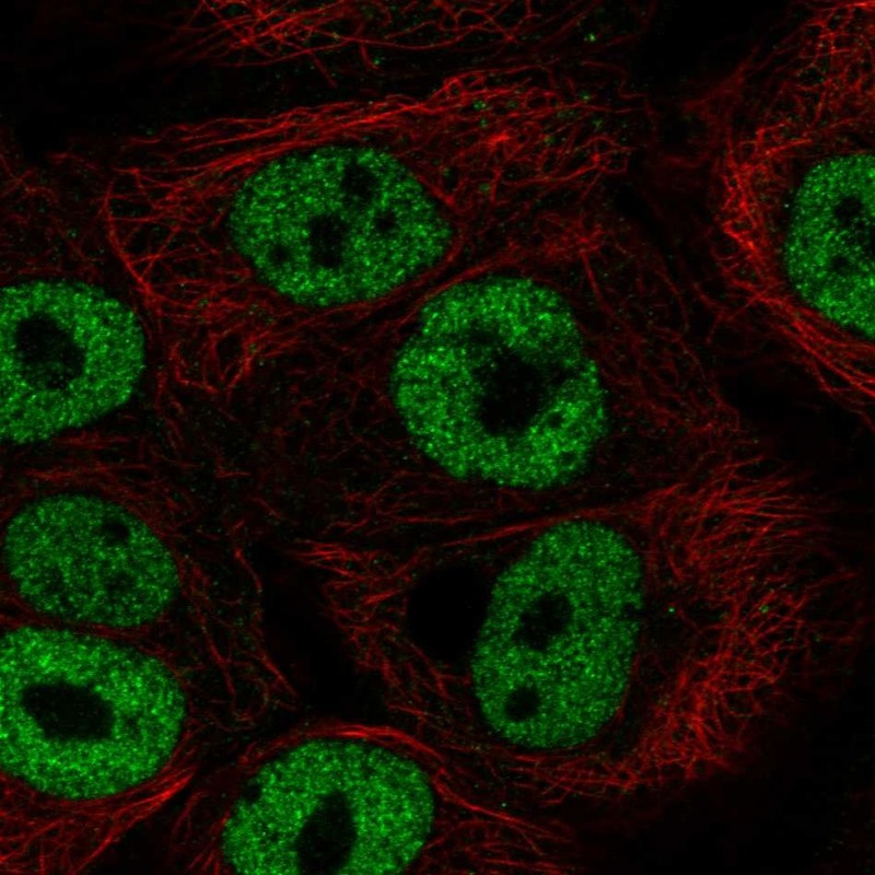 Anti-BNC1 Antibody