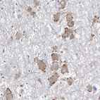 Anti-ECEL1 Antibody