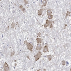Anti-ECEL1 Antibody