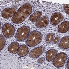 Anti-CCL28 Antibody