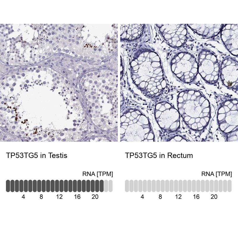 Anti-TP53TG5 Antibody