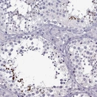 Immunohistochemical staining of human testis shows high expression.