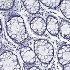 Immunohistochemical staining of human rectum shows low expression as expected.