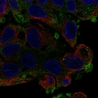 Anti-AQP11 Antibody