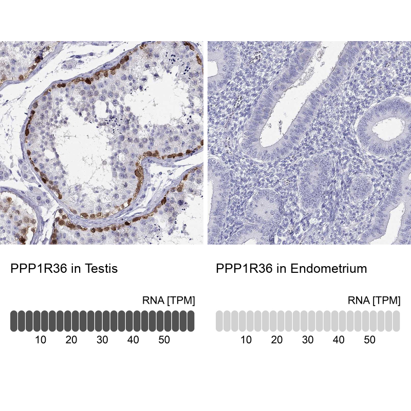 Anti-PPP1R36 Antibody