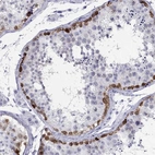 Immunohistochemical staining of human testis shows high expression.