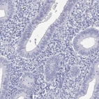 Immunohistochemical staining of human endometrium shows low expression as expected.