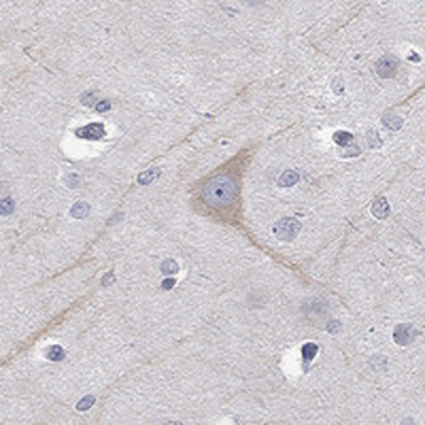 Anti-PCDH11X Antibody