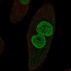 Anti-ZPLD1 Antibody