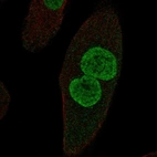 Anti-ZPLD1 Antibody