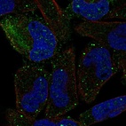 Anti-PCDHGB2 Antibody