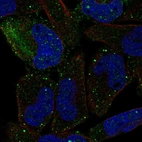 Anti-PCDHGB2 Antibody