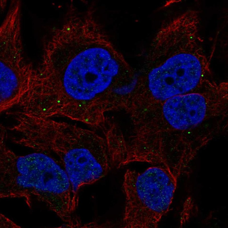 Anti-BORCS7 Antibody