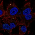 Anti-BORCS7 Antibody