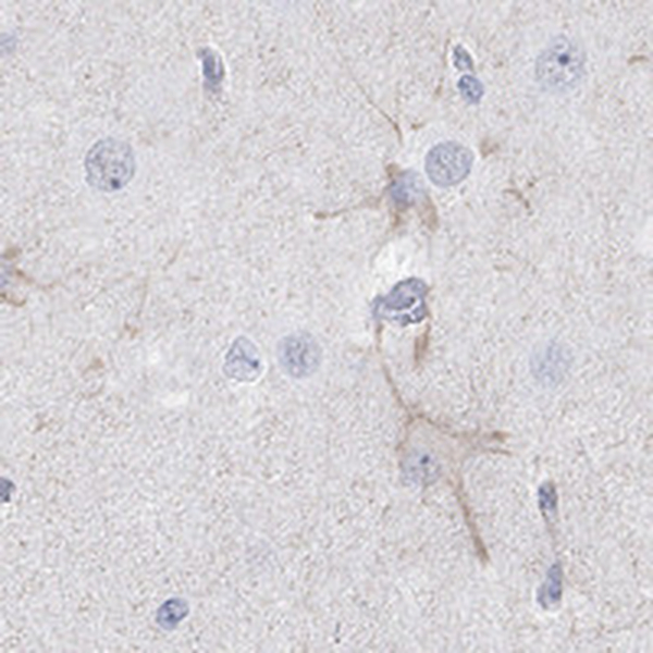Anti-KCNH8 Antibody