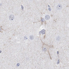 Anti-KCNH8 Antibody