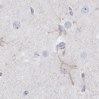 Anti-KCNH8 Antibody