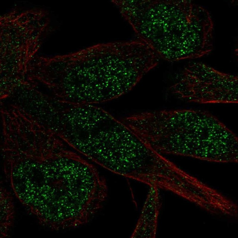 Anti-ZNF273 Antibody