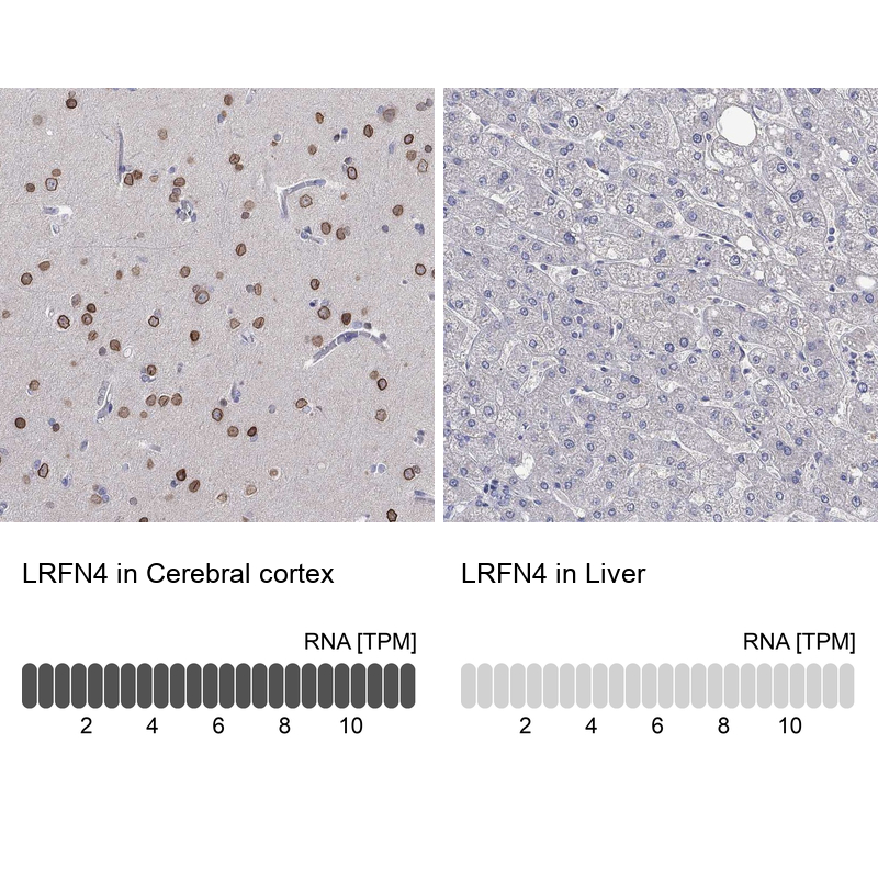 Anti-LRFN4 Antibody