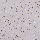 Immunohistochemical staining of human cerebral cortex shows high expression.
