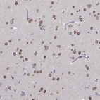 Anti-LRFN4 Antibody