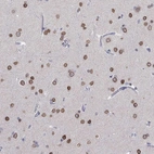 Immunohistochemical staining of human cerebral cortex shows high expression.