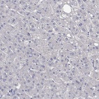 Anti-LRFN4 Antibody