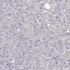 Immunohistochemical staining of human liver shows low expression as expected.