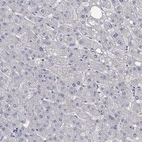 Immunohistochemical staining of human liver shows low expression as expected.